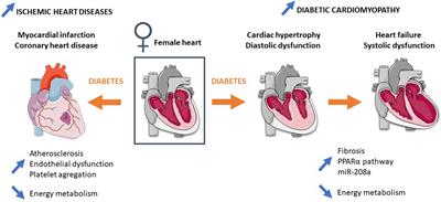 Sex Differences of the Diabetic Heart